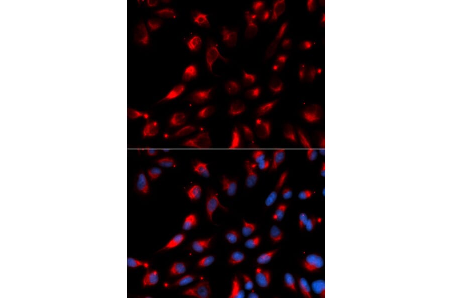 Immunofluorescence - CPE Antibody from Signalway Antibody (32861) - Antibodies.com