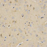 Immunohistochemistry - CPE Antibody from Signalway Antibody (32861) - Antibodies.com