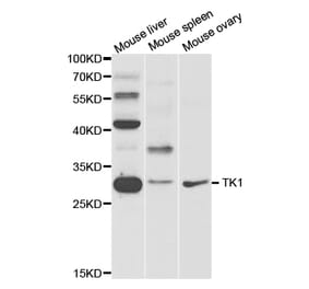 Western blot - TK1 Antibody from Signalway Antibody (32920) - Antibodies.com