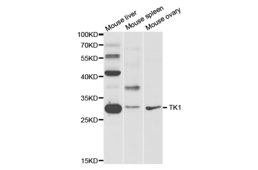 Western blot - TK1 Antibody from Signalway Antibody (32920) - Antibodies.com