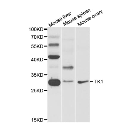 Western blot - TK1 Antibody from Signalway Antibody (32920) - Antibodies.com