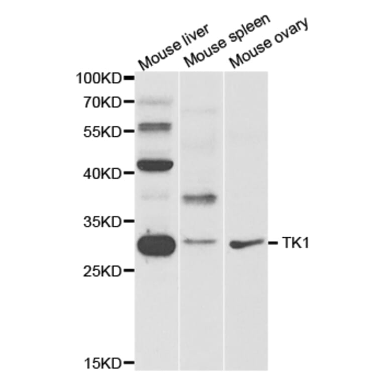 Western blot - TK1 Antibody from Signalway Antibody (32920) - Antibodies.com