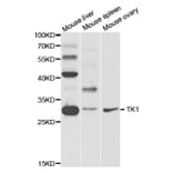 Western blot - TK1 Antibody from Signalway Antibody (32920) - Antibodies.com
