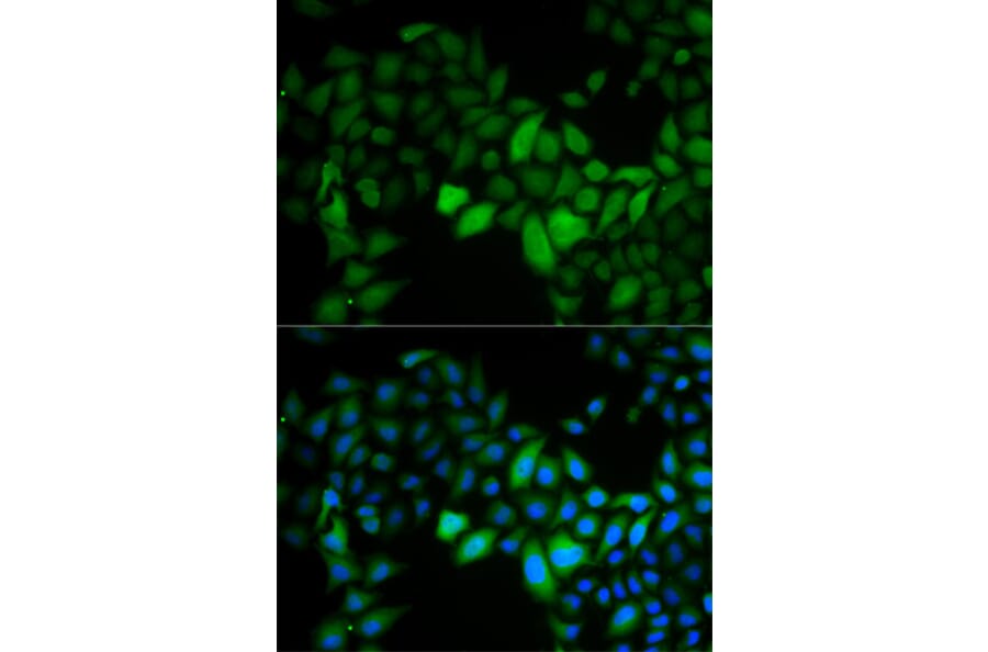 Immunofluorescence - TK1 Antibody from Signalway Antibody (32920) - Antibodies.com