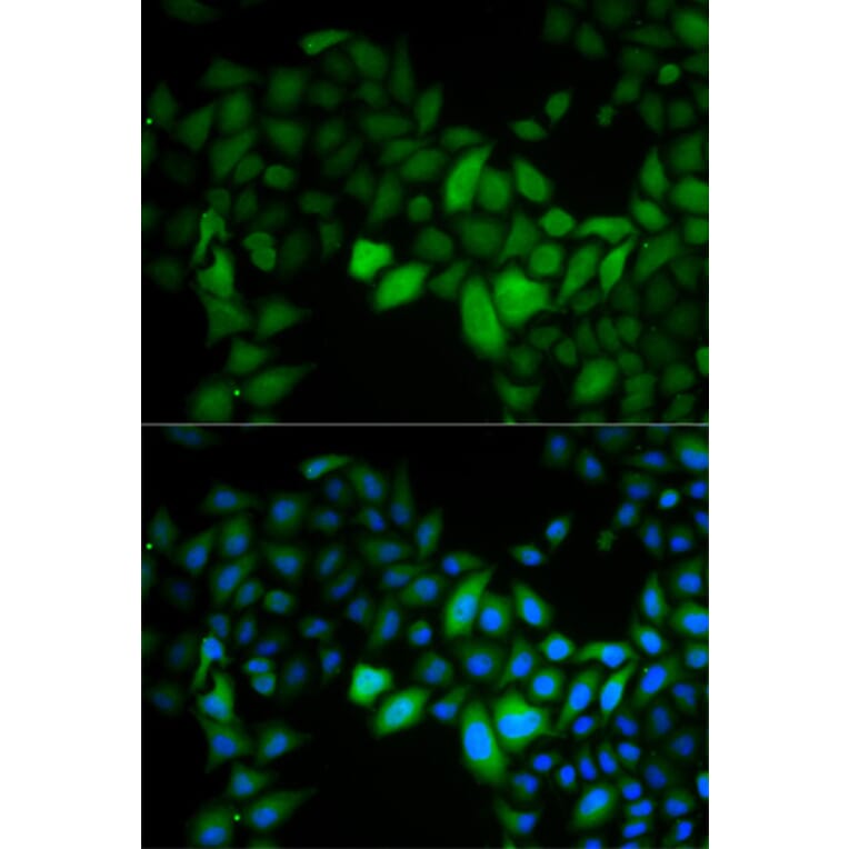 Immunofluorescence - TK1 Antibody from Signalway Antibody (32920) - Antibodies.com