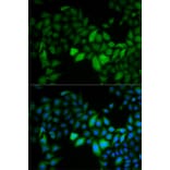 Immunofluorescence - TK1 Antibody from Signalway Antibody (32920) - Antibodies.com