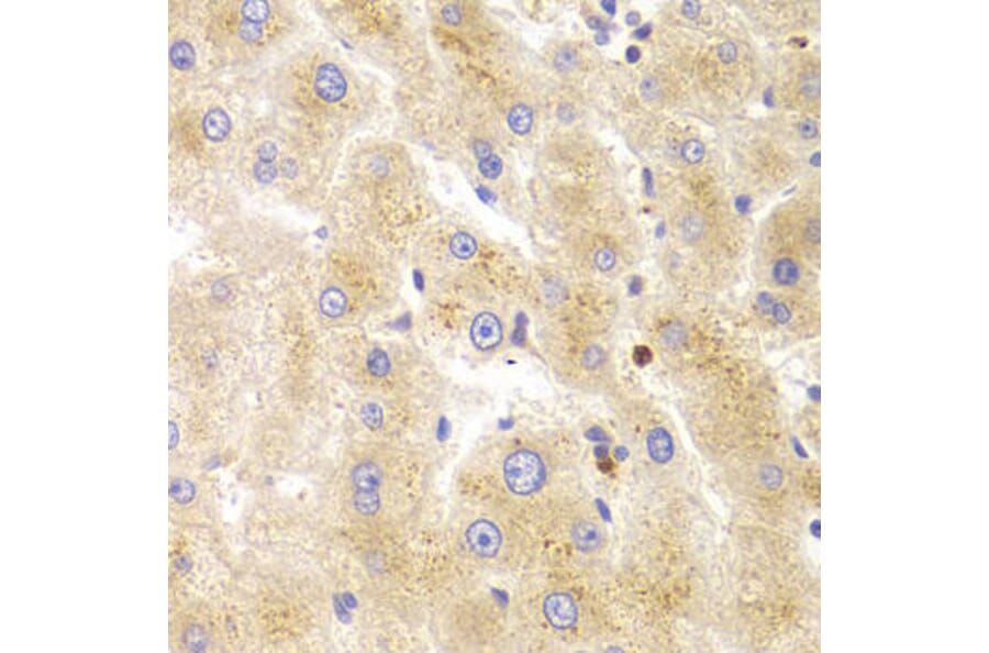 Immunohistochemistry - TK1 Antibody from Signalway Antibody (32920) - Antibodies.com