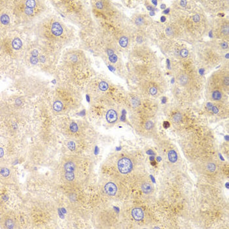 Immunohistochemistry - TK1 Antibody from Signalway Antibody (32920) - Antibodies.com