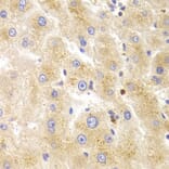 Immunohistochemistry - TK1 Antibody from Signalway Antibody (32920) - Antibodies.com