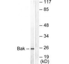 Western blot - Bak Antibody from Signalway Antibody (33326) - Antibodies.com