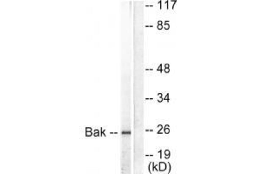 Western blot - Bak Antibody from Signalway Antibody (33326) - Antibodies.com