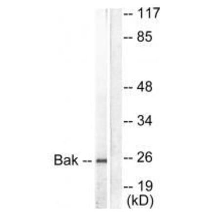 Western blot - Bak Antibody from Signalway Antibody (33326) - Antibodies.com