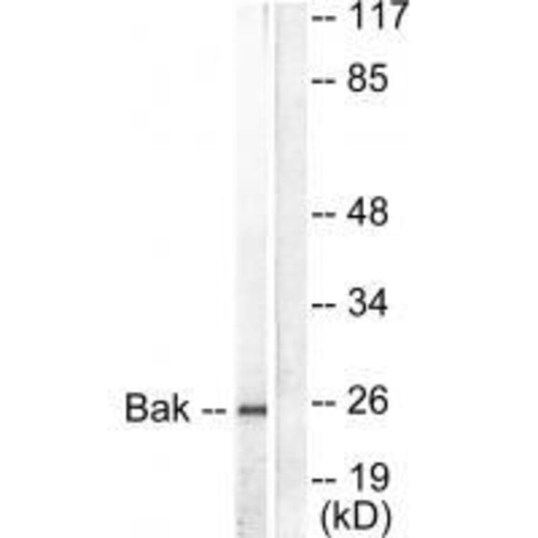 Western blot - Bak Antibody from Signalway Antibody (33326) - Antibodies.com