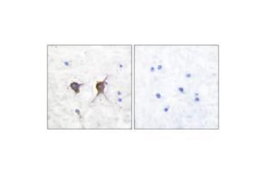 Immunohistochemistry - Bax Antibody from Signalway Antibody (33327) - Antibodies.com