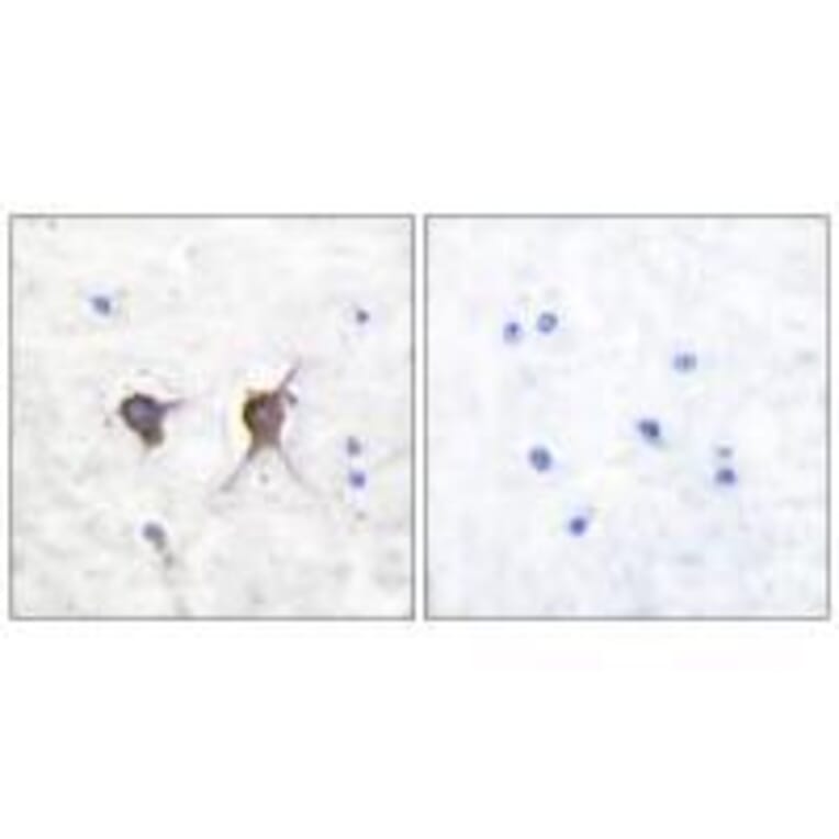 Immunohistochemistry - Bax Antibody from Signalway Antibody (33327) - Antibodies.com
