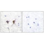 Immunohistochemistry - Bax Antibody from Signalway Antibody (33327) - Antibodies.com