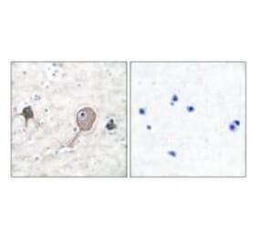 Immunohistochemistry - NSE Antibody from Signalway Antibody (33451) - Antibodies.com