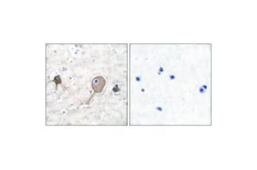 Immunohistochemistry - NSE Antibody from Signalway Antibody (33451) - Antibodies.com