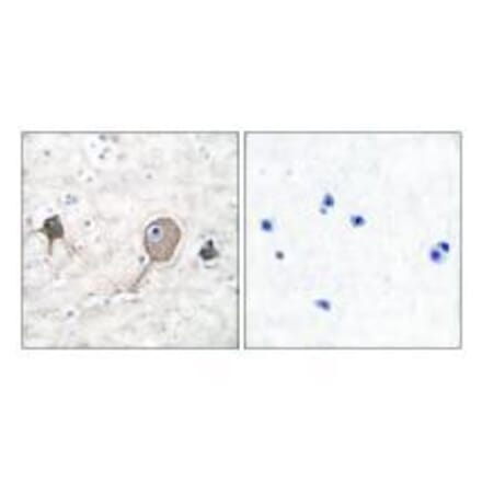 Immunohistochemistry - NSE Antibody from Signalway Antibody (33451) - Antibodies.com