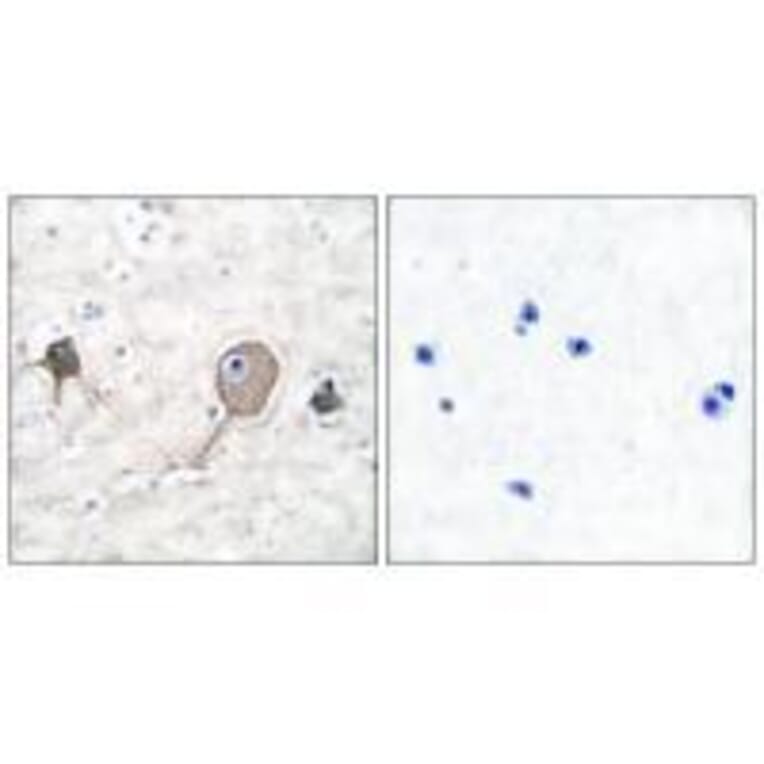 Immunohistochemistry - NSE Antibody from Signalway Antibody (33451) - Antibodies.com