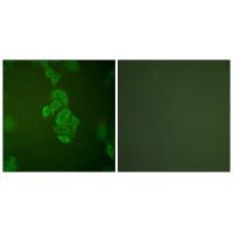 Immunofluorescence - NSE Antibody from Signalway Antibody (33451) - Antibodies.com