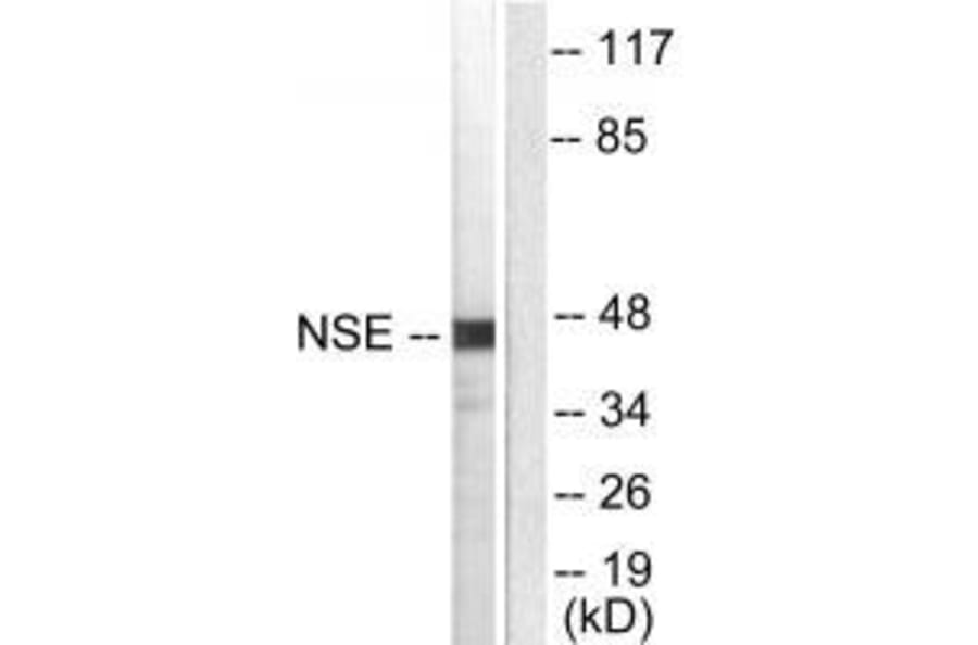 Western blot - NSE Antibody from Signalway Antibody (33451) - Antibodies.com