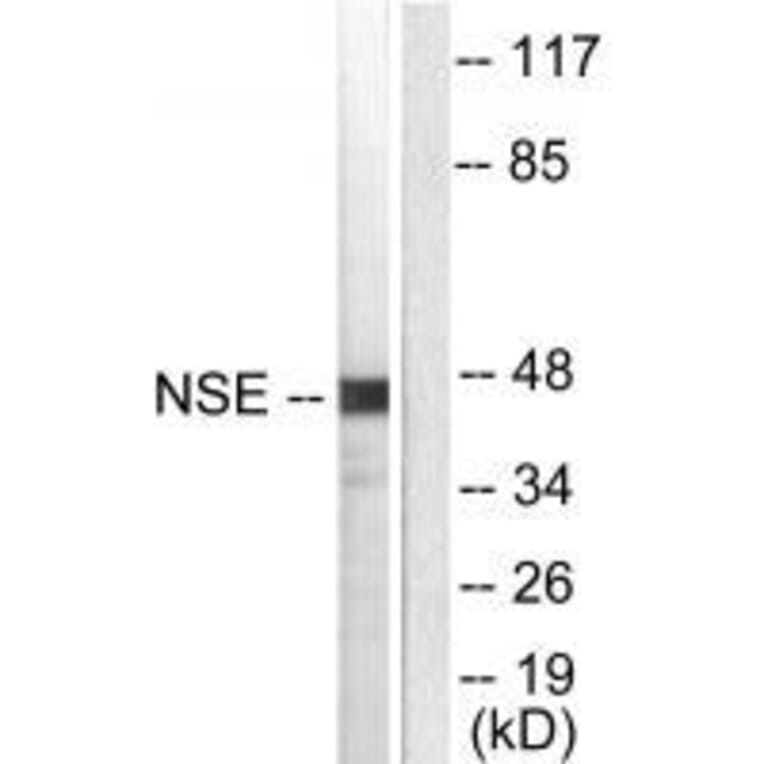 Western blot - NSE Antibody from Signalway Antibody (33451) - Antibodies.com