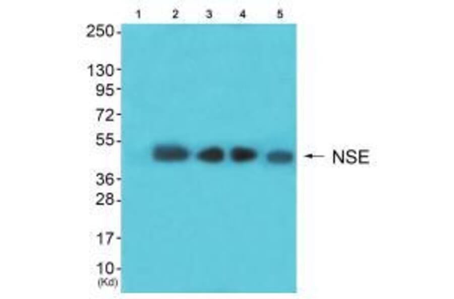 Western blot - NSE Antibody from Signalway Antibody (33451) - Antibodies.com