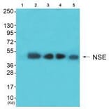 Western blot - NSE Antibody from Signalway Antibody (33451) - Antibodies.com