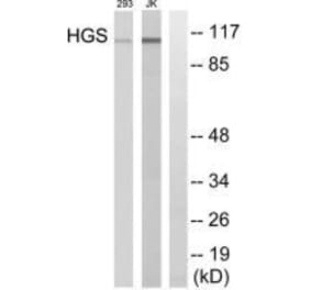 Western blot - HGS Antibody from Signalway Antibody (33572) - Antibodies.com