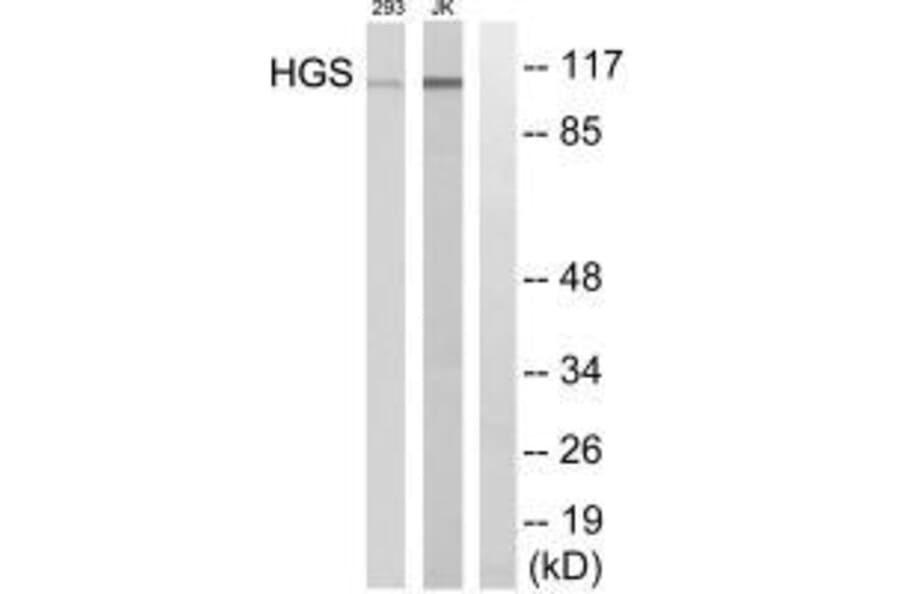Western blot - HGS Antibody from Signalway Antibody (33572) - Antibodies.com