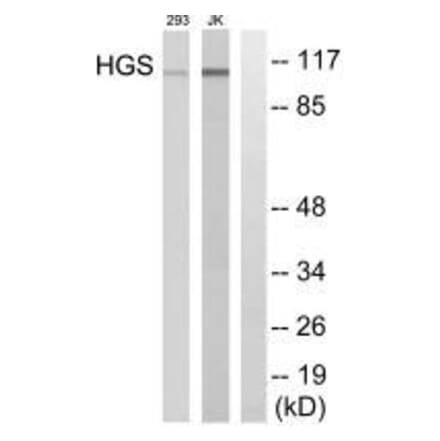 Western blot - HGS Antibody from Signalway Antibody (33572) - Antibodies.com