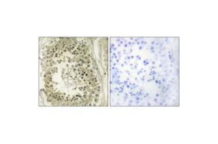 Immunohistochemistry - HGS Antibody from Signalway Antibody (33572) - Antibodies.com