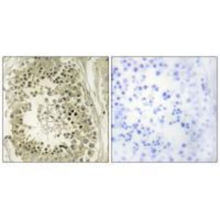 Immunohistochemistry - HGS Antibody from Signalway Antibody (33572) - Antibodies.com