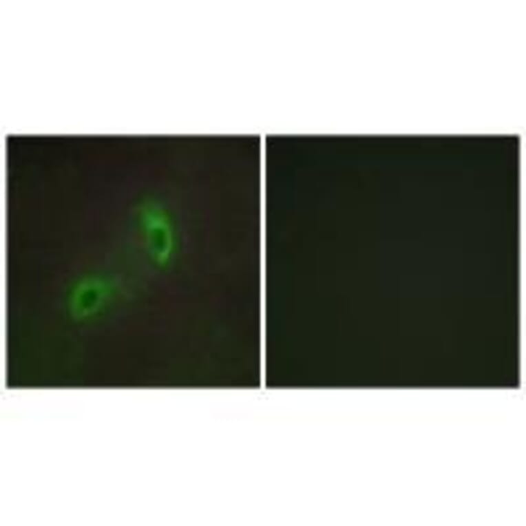 Immunofluorescence - HGS Antibody from Signalway Antibody (33572) - Antibodies.com