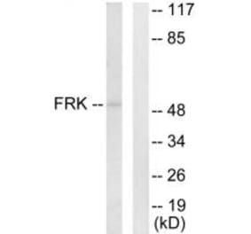 Western blot - FRK Antibody from Signalway Antibody (33770) - Antibodies.com