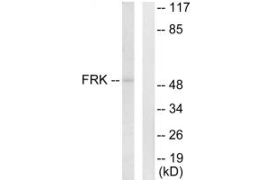 Western blot - FRK Antibody from Signalway Antibody (33770) - Antibodies.com