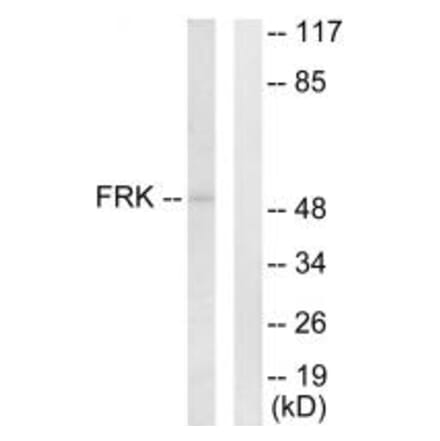 Western blot - FRK Antibody from Signalway Antibody (33770) - Antibodies.com