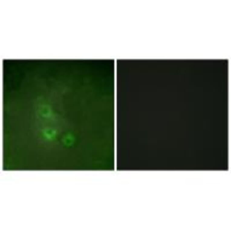Immunofluorescence - FRK Antibody from Signalway Antibody (33770) - Antibodies.com