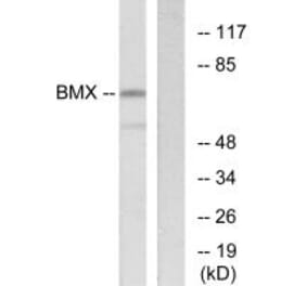 Western blot - BMX Antibody from Signalway Antibody (33798) - Antibodies.com