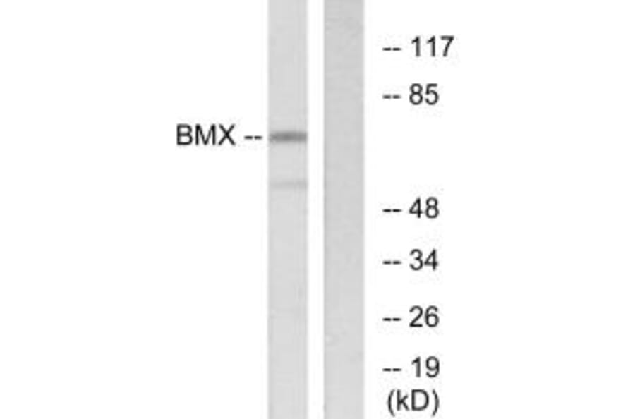 Western blot - BMX Antibody from Signalway Antibody (33798) - Antibodies.com