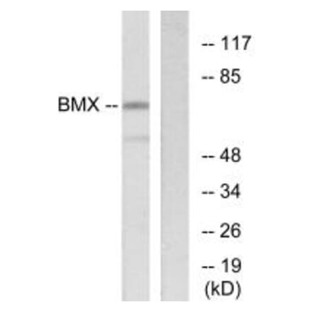 Western blot - BMX Antibody from Signalway Antibody (33798) - Antibodies.com
