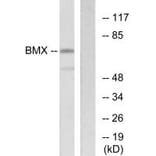 Western blot - BMX Antibody from Signalway Antibody (33798) - Antibodies.com