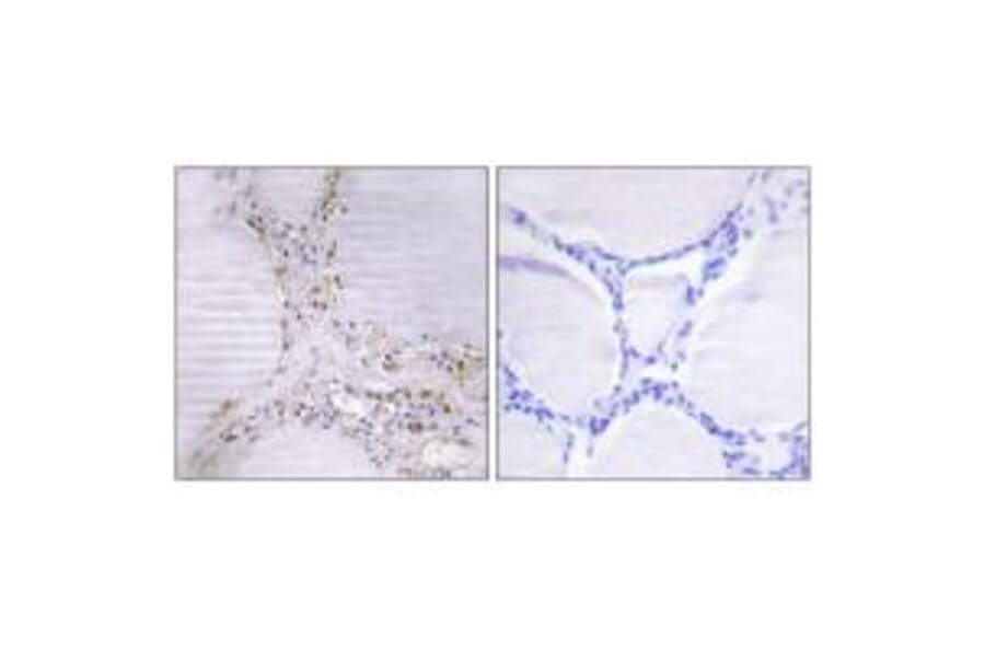 Immunohistochemistry - BMX Antibody from Signalway Antibody (33798) - Antibodies.com