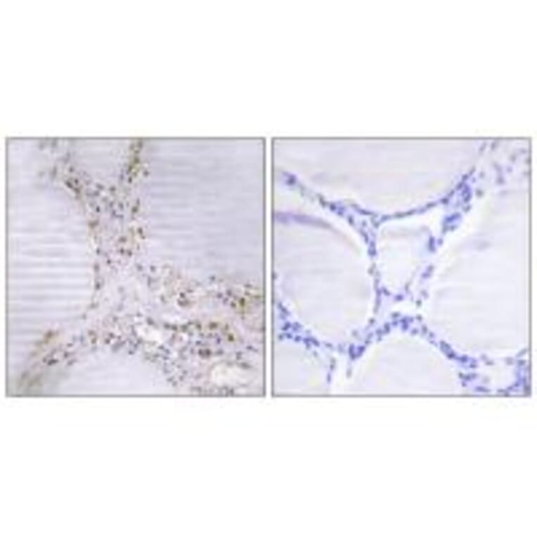Immunohistochemistry - BMX Antibody from Signalway Antibody (33798) - Antibodies.com