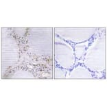 Immunohistochemistry - BMX Antibody from Signalway Antibody (33798) - Antibodies.com