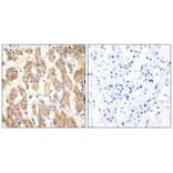 Immunohistochemistry - BAX Antibody from Signalway Antibody (34260) - Antibodies.com