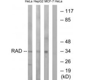 Western blot - RAD Antibody from Signalway Antibody (34723) - Antibodies.com