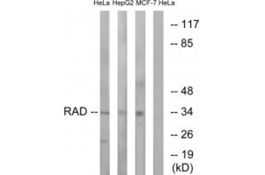 Western blot - RAD Antibody from Signalway Antibody (34723) - Antibodies.com