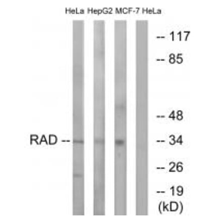 Western blot - RAD Antibody from Signalway Antibody (34723) - Antibodies.com
